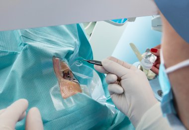 Kontakt lens check-up