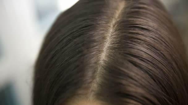 Проблема волос с перхоти — стоковое видео