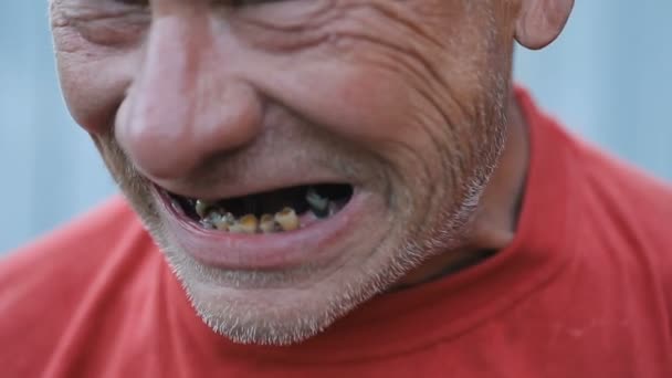 Ruttna tänder av berusad man — Stockvideo