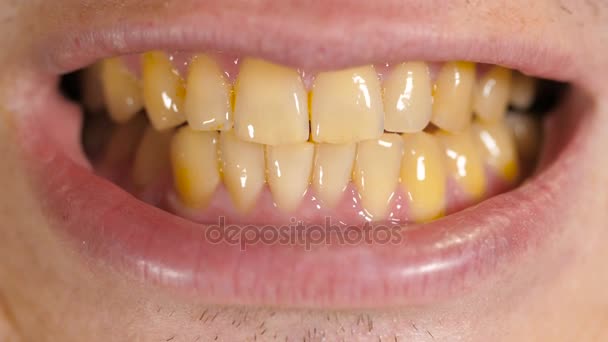 Желтые зубы человека — стоковое видео