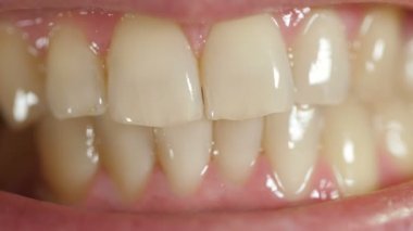 Man showing teeth
