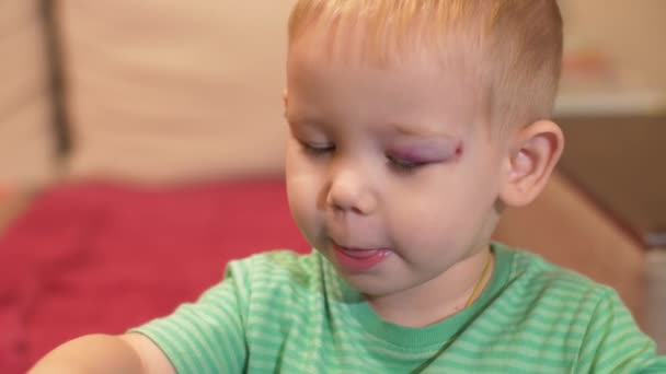 Little boy with a black eye playing with toys — Stockvideo