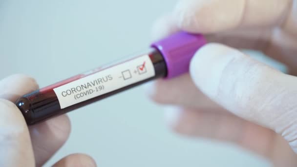 Test auf Coronavirus in der Hand des Arztes — Stockvideo