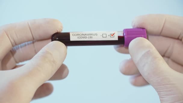 Test Covid-19 positivo. Tubo di sangue in mani . — Video Stock