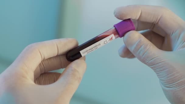 Coronavirus test positivo nelle mani di un medico — Video Stock