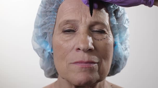 Mulher está se preparando para um lifting facial — Vídeo de Stock