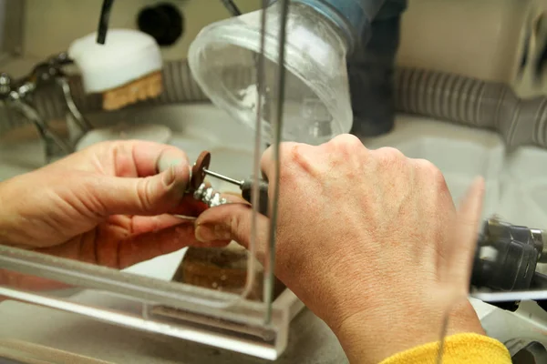 Руки стоматолога обробка металевого орального протезування — стокове фото