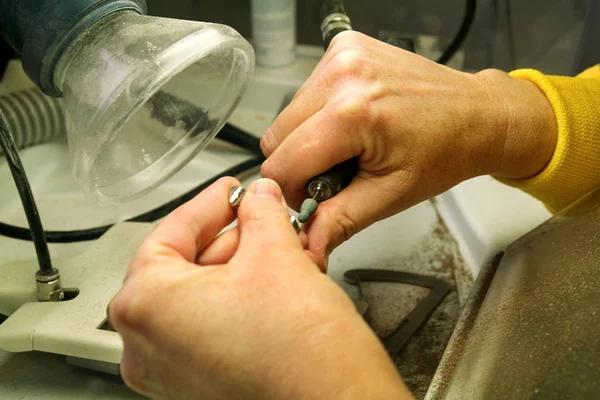 歯科技工士が金属の経口義足を処理の手 — ストック写真