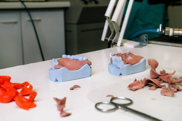 Proces van het maken van acryl tandheelkundige protheses — Stockfoto