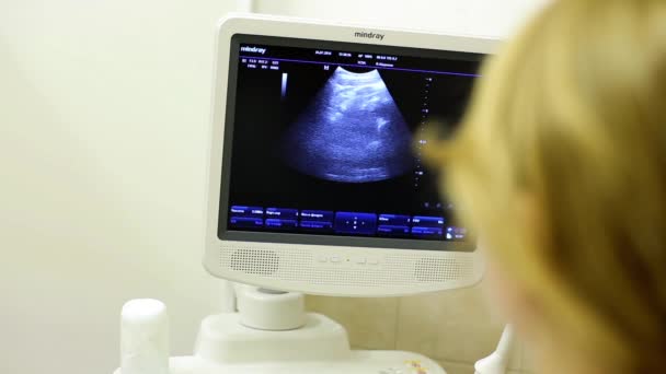 Monitor de ultrasonido. Aparato de ultrasonido en el hospital — Vídeos de Stock