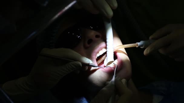 O dentista trata a menina dos dentes — Vídeo de Stock