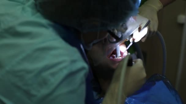 Odontologia. Limpeza de dentes de hardware — Vídeo de Stock