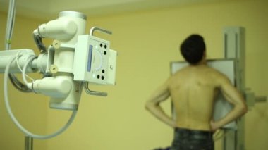 Göğüs röntgeni yapan erkek.