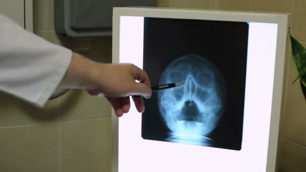 Dottore che mostra una penna su una radiografia — Video Stock