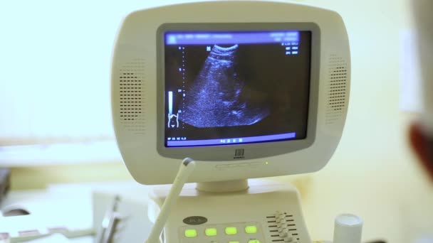 Ultrason monitör. Klinikte ultrason cihazı — Stok video