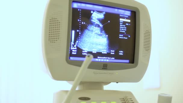 Ultraschallgerät in der Klinik — Stockvideo