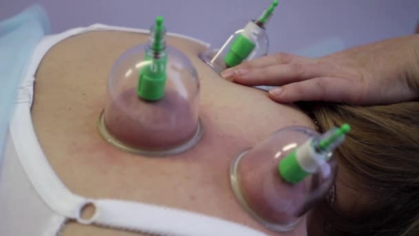 Vacuum massage with the use of cans in a medical clinic — Stock Video