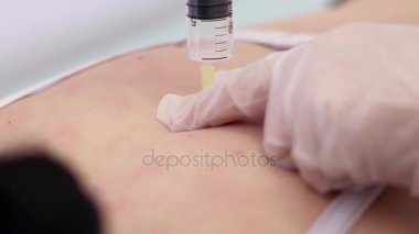 Ozon tedavisi. Bir doktor bir şırınga ile