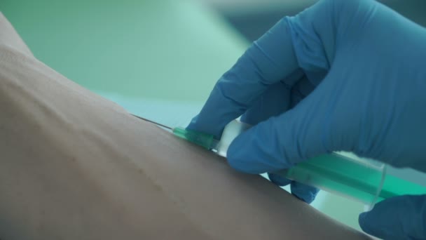 Arzt macht Patient eine Injektion in eine Vene. Teil 2. — Stockvideo
