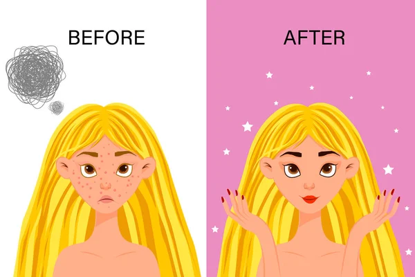 Personaje femenino "antes" y "después" procedimiento cosmético combate el acné. Estilo de dibujos animados. Ilustración vectorial . — Vector de stock