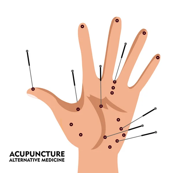 Palm with acupuncture points scheme. Cartoon style. Vector illustration. — Stock Vector