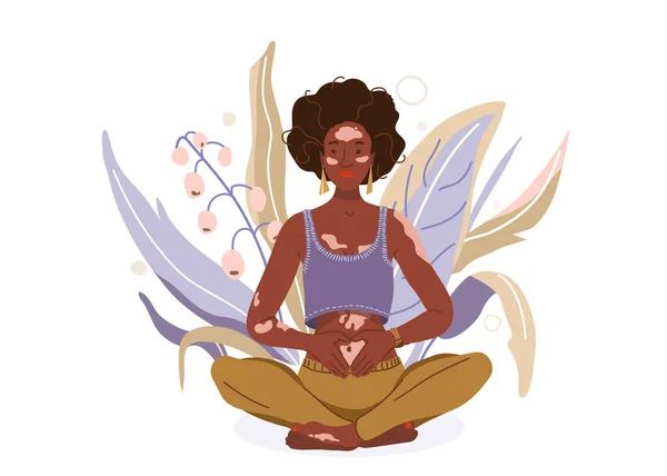 Love yourself with problem vitiligo skin vector background. Self-care body wellness concept. African woman sitting in yoga posture. Girl fold her hands on her stomach, fingers formed heart shape — 스톡 벡터