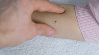 El dokunur womans yandan köstebek adamın. Doktor tıbbi tarama. El ve köstebek kadar yakın.
