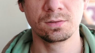 Adam ağzındaki yaralar dokunarak. Uçuk. Dudak tedavisi. Yakın çekim, dudakları herpes ile mans. Önden Görünüm.