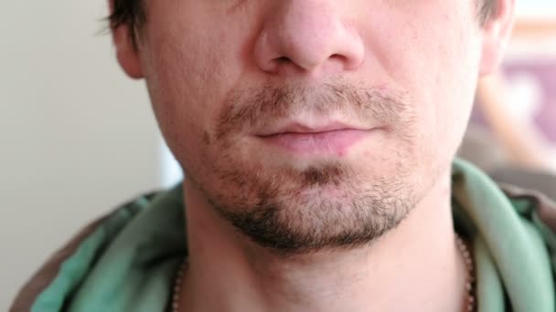 Herpes. Tratamiento labial. Primer plano de los labios del hombre con herpes. Vista frontal . — Vídeos de Stock