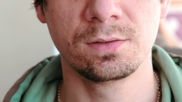 Homem a tocar feridas nos lábios. Herpes. Tratamento labial. Close-up dos lábios masculinos com herpes. Vista frontal . — Vídeo de Stock