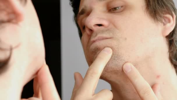 Giovane uomo stringe il brufolo sul viso di fronte allo specchio. Primo piano mans viso con problemi di pelle . — Video Stock
