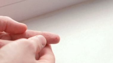 Üzerinde parmak kesmek bir el mans. Kan akar.