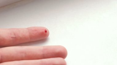 Üzerinde parmak kesmek bir el mans. Kan akar.