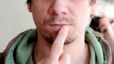 Uçuk. Dudak tedavisi. Yakın çekim, dudakları herpes ile mans. Erkek krem dudaklarından koyar. Önden Görünüm.