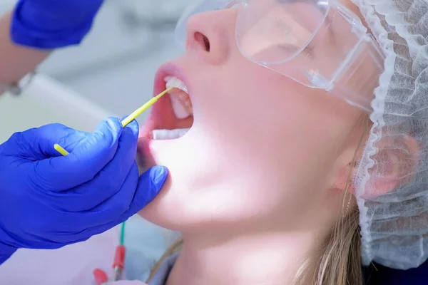 Dentist make fluoridation of teeth after ultrasonic cleaning for young woman. Stock Picture