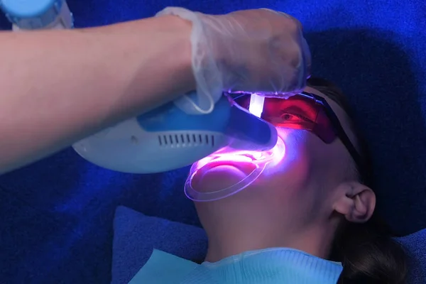 LED procedura cosmetica sbiancante bellezza per i denti delle donne in clinica odontoiatrica . — Foto Stock