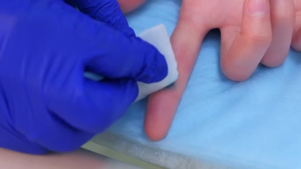 Chirurg Arzt appliziert grünes Antiseptikum auf entfernte Warze am Finger des Patienten. — Stockvideo