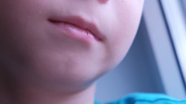 Sick child boy with cracked dry lip, mouth closeup. — 图库视频影像