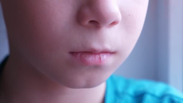 Barn pojke med herpes öm på läppen bländar sin läpp, mun närbild. — Stockvideo