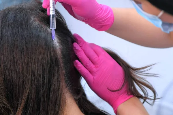 Médico tricólogo haciendo inyecciones mesoterapia en cuero cabelludo de mujer, vista de cerca. — Foto de Stock