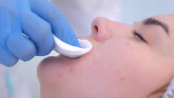Косметолог вытирает губы хлопчатобумажной салфетки во время постоянной процедуры для женщин. — стоковое видео