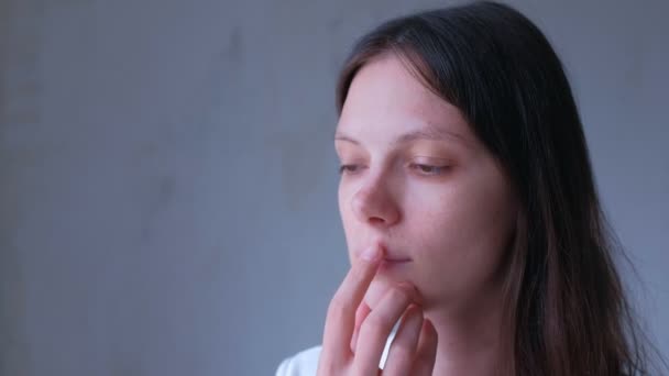 Portrait of sick woman with herpes virus sore on upper lip on mouth. — Stock Video