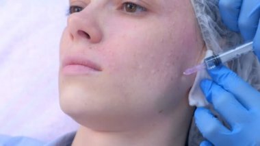 Kozmetik uzmanı kadın cildine birden fazla enjeksiyon yapıyor..