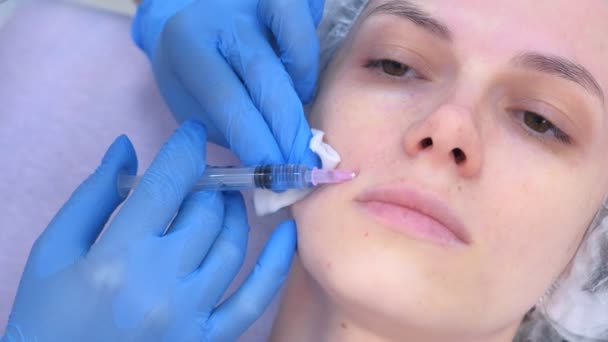 Läkaren gör flera injektioner i kvinnor ansikte hud under mesoterapi. — Stockvideo