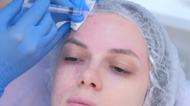 Косметик делает несколько инъекций биоревитализации в кожу лба девушки . — стоковое видео