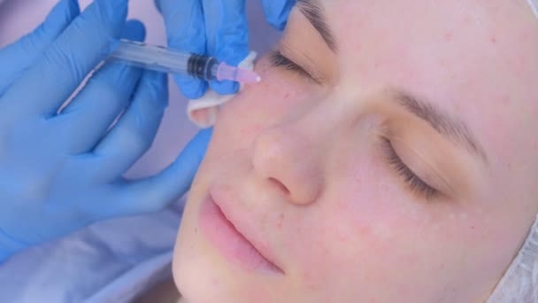 Cosmetoloog het maken van meerdere injecties biorevitalisatie in vrouw gezicht huid. — Stockvideo
