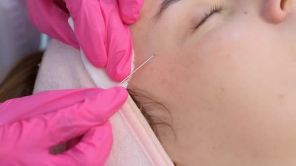 Cosmetólogo pinchando acné en la cara de las mujeres usando aguja y limpiando almohadillas de algodón. — Vídeos de Stock