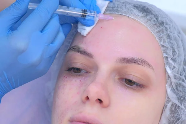 Косметик делает несколько инъекций биоревитализации в кожу лба девушки . — стоковое фото