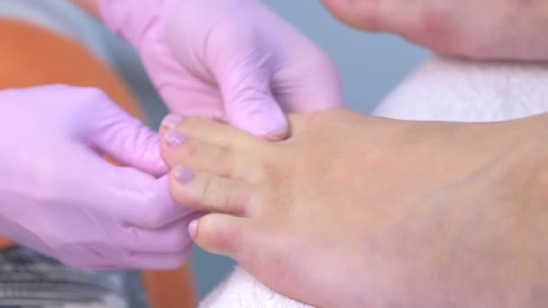 教育学硕士正在妇女的脚上涂药膏，这是在做足底除皱手术之后. — 图库视频影像