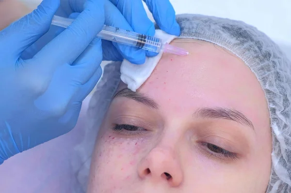 Cosmetologo fa iniezioni multiple biorivitalizzazione nella pelle della fronte ragazza. — Foto Stock